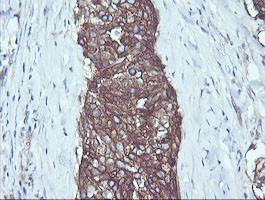 RALB Antibody in Immunohistochemistry (Paraffin) (IHC (P))