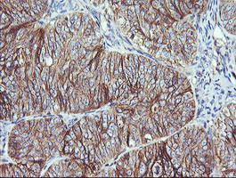 RALB Antibody in Immunohistochemistry (Paraffin) (IHC (P))