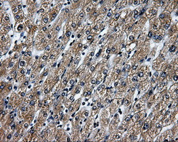 RALBP1 Antibody in Immunohistochemistry (Paraffin) (IHC (P))