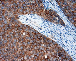 RALBP1 Antibody in Immunohistochemistry (Paraffin) (IHC (P))