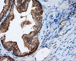 RALBP1 Antibody in Immunohistochemistry (Paraffin) (IHC (P))