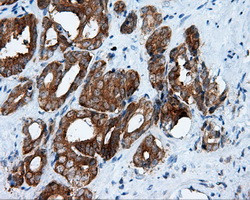 RALBP1 Antibody in Immunohistochemistry (Paraffin) (IHC (P))