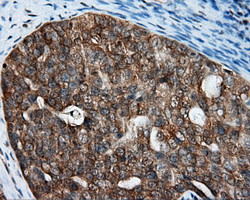 RALBP1 Antibody in Immunohistochemistry (Paraffin) (IHC (P))