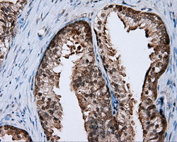 RALBP1 Antibody in Immunohistochemistry (Paraffin) (IHC (P))