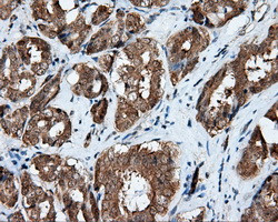 RALBP1 Antibody in Immunohistochemistry (Paraffin) (IHC (P))