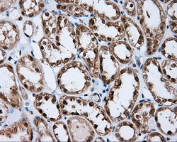 RALBP1 Antibody in Immunohistochemistry (Paraffin) (IHC (P))