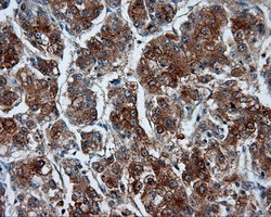 RALBP1 Antibody in Immunohistochemistry (Paraffin) (IHC (P))