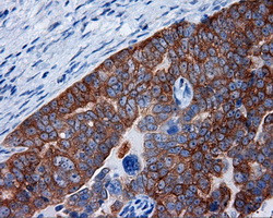 RALBP1 Antibody in Immunohistochemistry (Paraffin) (IHC (P))