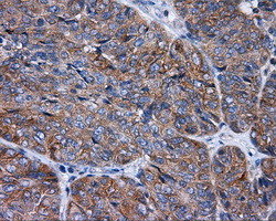 RALBP1 Antibody in Immunohistochemistry (Paraffin) (IHC (P))