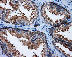 RALBP1 Antibody in Immunohistochemistry (Paraffin) (IHC (P))