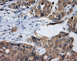 RALBP1 Antibody in Immunohistochemistry (Paraffin) (IHC (P))