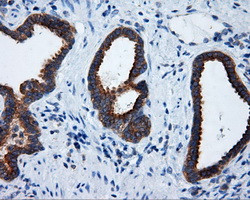 RALBP1 Antibody in Immunohistochemistry (Paraffin) (IHC (P))