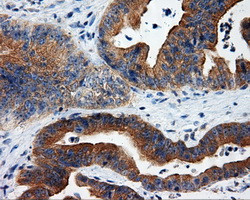 RALBP1 Antibody in Immunohistochemistry (Paraffin) (IHC (P))