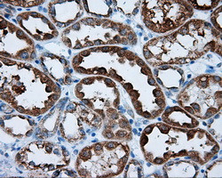 RALBP1 Antibody in Immunohistochemistry (Paraffin) (IHC (P))