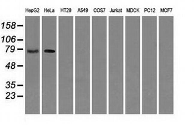 RALBP1 Antibody in Western Blot (WB)