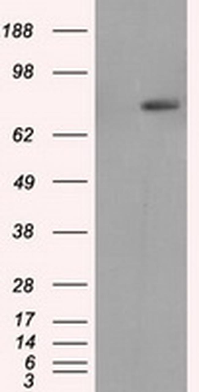 RALBP1 Antibody in Western Blot (WB)