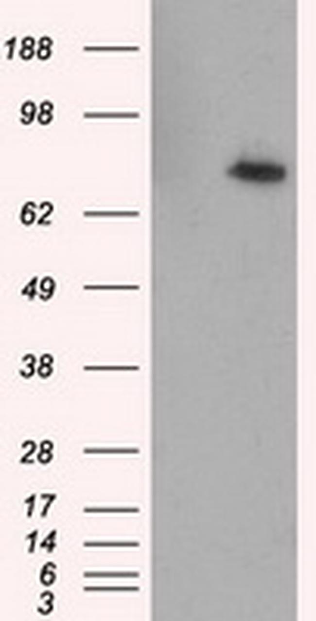 RALBP1 Antibody in Western Blot (WB)