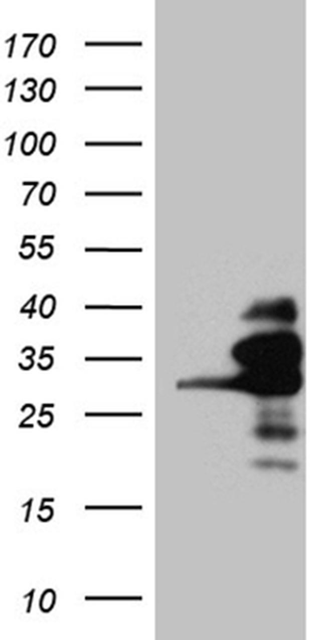 RANBP1 Antibody in Western Blot (WB)