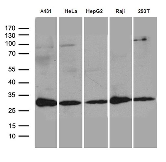 RANBP1 Antibody in Western Blot (WB)