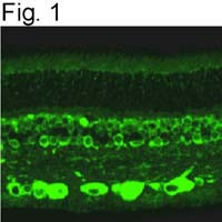 RANBP2 Antibody in Immunohistochemistry (IHC)