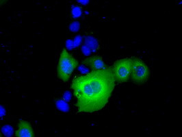 RANGAP1 Antibody in Immunocytochemistry (ICC/IF)