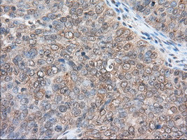 RANGAP1 Antibody in Immunohistochemistry (Paraffin) (IHC (P))