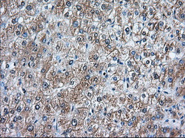 RANGAP1 Antibody in Immunohistochemistry (Paraffin) (IHC (P))