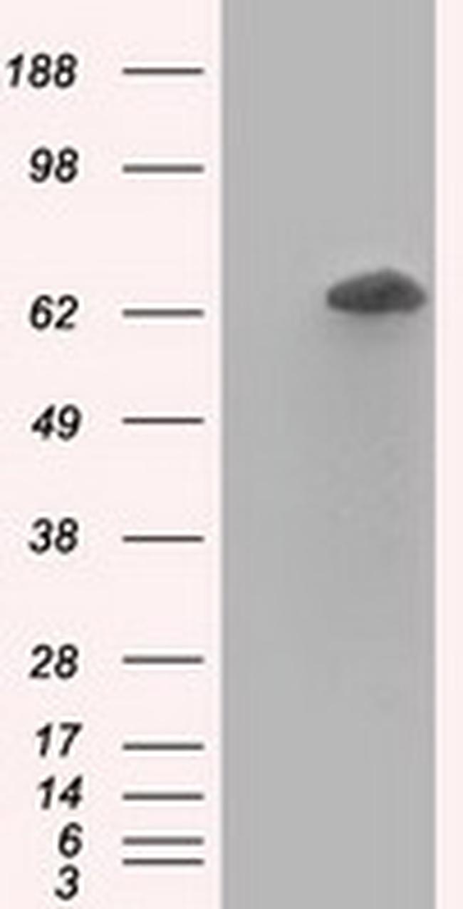 RANGAP1 Antibody in Western Blot (WB)