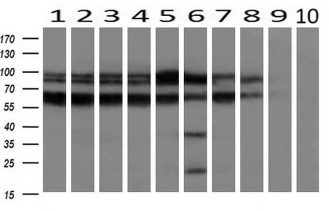 RANGAP1 Antibody in Western Blot (WB)