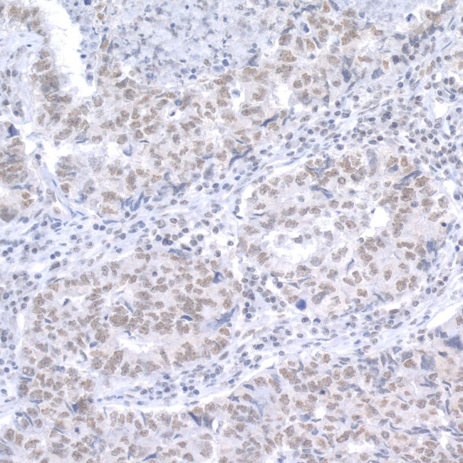 RAP1 Antibody in Immunohistochemistry (IHC)