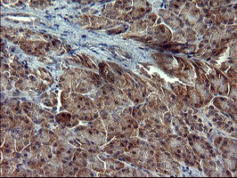 RAPGEF1 Antibody in Immunohistochemistry (Paraffin) (IHC (P))