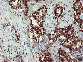 RAPGEF1 Antibody in Immunohistochemistry (Paraffin) (IHC (P))