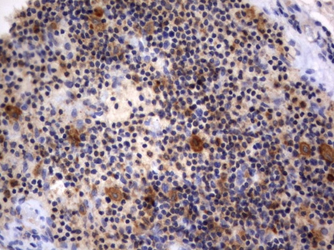 RAPGEF1 Antibody in Immunohistochemistry (Paraffin) (IHC (P))