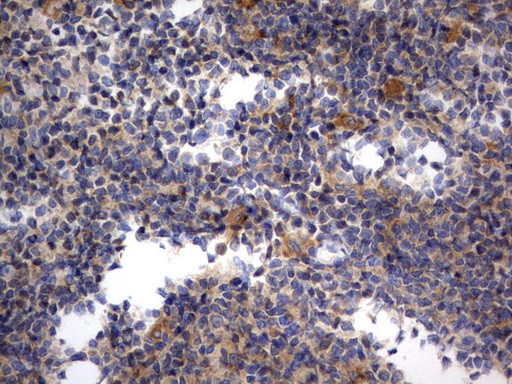 RAPGEF1 Antibody in Immunohistochemistry (Paraffin) (IHC (P))