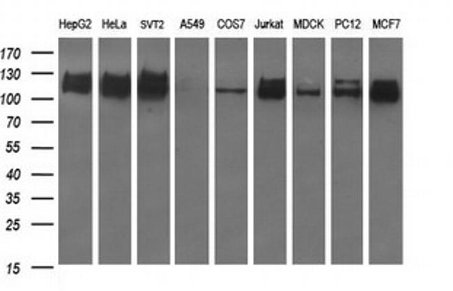 RAPGEF1 Antibody in Western Blot (WB)