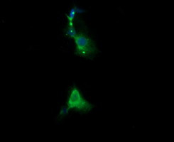 RARRES1 Antibody in Immunocytochemistry (ICC/IF)