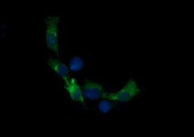 RARRES1 Antibody in Immunocytochemistry (ICC/IF)