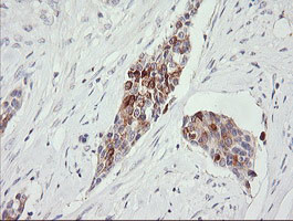 RARRES1 Antibody in Immunohistochemistry (Paraffin) (IHC (P))