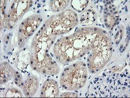 RARRES1 Antibody in Immunohistochemistry (Paraffin) (IHC (P))