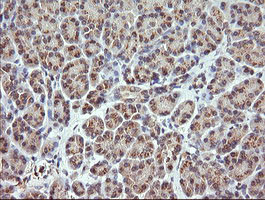 RARRES1 Antibody in Immunohistochemistry (Paraffin) (IHC (P))