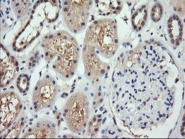 RARRES1 Antibody in Immunohistochemistry (Paraffin) (IHC (P))