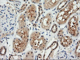 RARRES1 Antibody in Immunohistochemistry (Paraffin) (IHC (P))