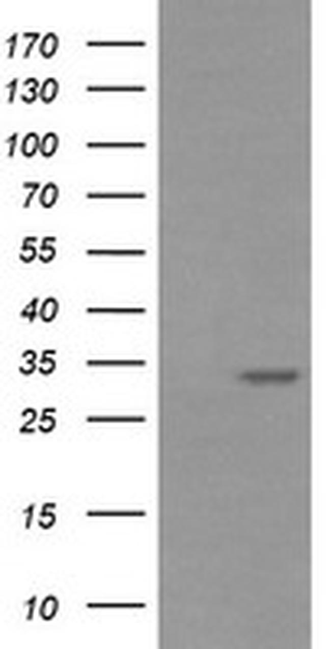 RARRES1 Antibody in Western Blot (WB)