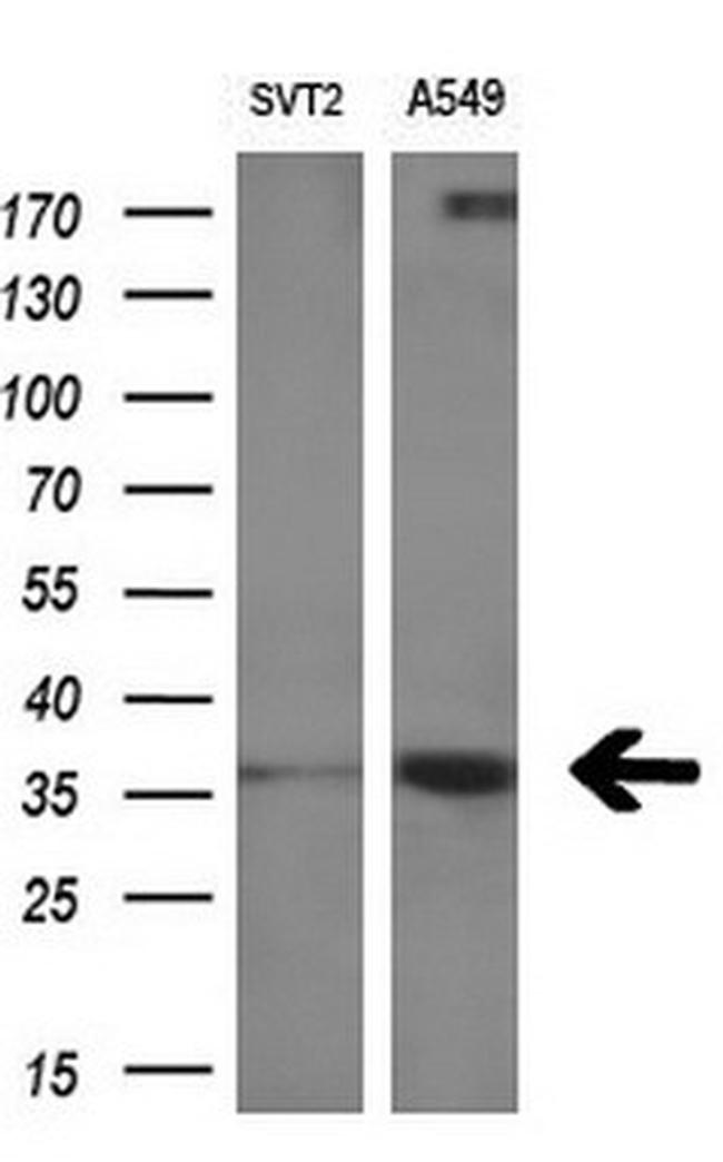 RARRES1 Antibody in Western Blot (WB)