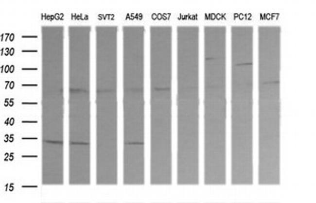 RARRES1 Antibody in Western Blot (WB)