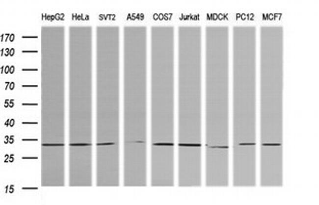 RARRES1 Antibody in Western Blot (WB)