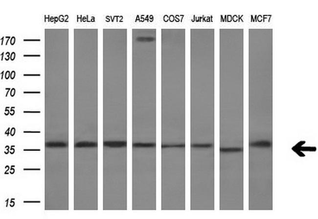 RARRES1 Antibody in Western Blot (WB)