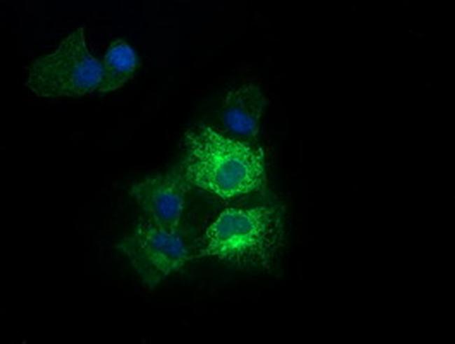 RARRES1 Antibody in Western Blot (WB)