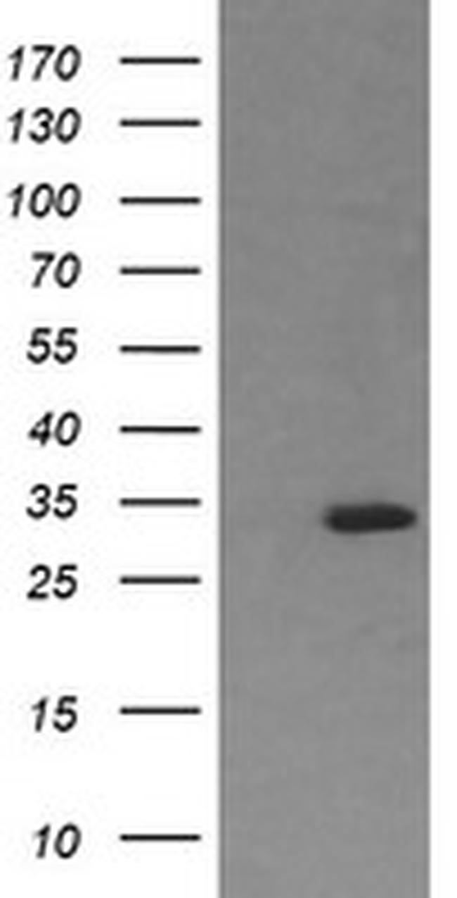 RARRES1 Antibody in Western Blot (WB)