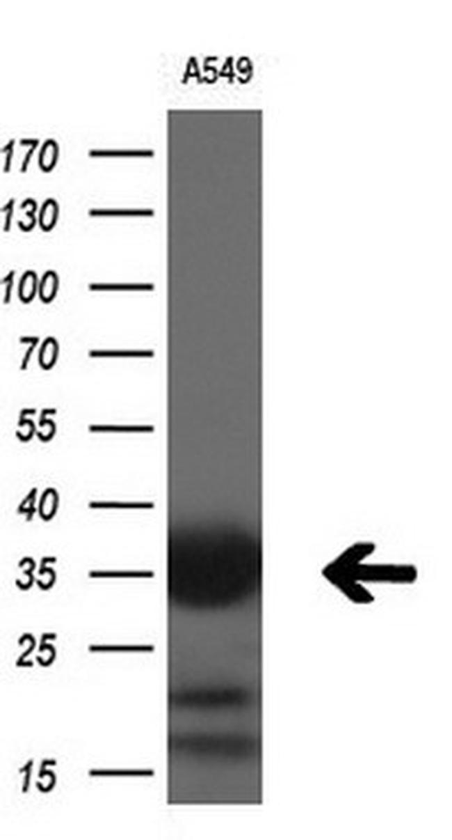 RARRES1 Antibody in Western Blot (WB)